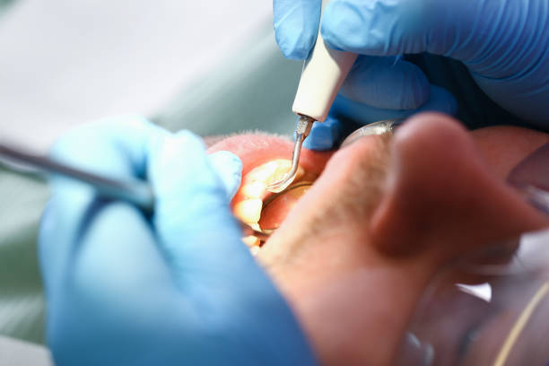Best Pediatric Emergency Dentist in Bloomington, TX