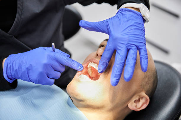 Best Emergency Wisdom Teeth Removal in Bloomington, TX