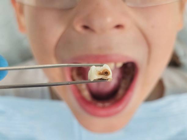 Best Emergency Treatment for Toothache in Bloomington, TX